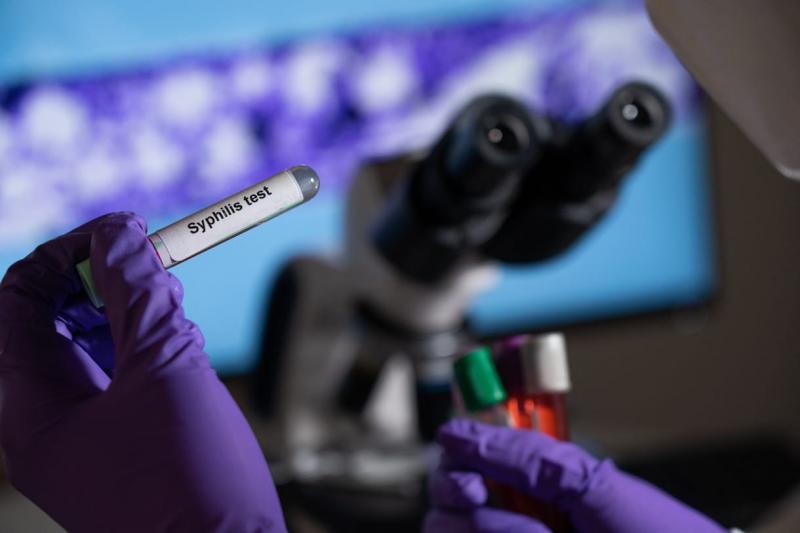 Magyarországon drámai mértékben emelkedett a veleszületett szifilisz eseteinek száma.